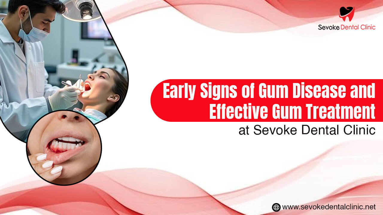 Early Signs of Gum Disease and Effective Gum Treatment at Sevoke Dental Clinic